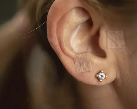 Persona recibiendo una sesión de auriculoterapia con pequeñas agujas o semillas en la oreja para estimular puntos energéticos y promover el equilibrio del cuerpo