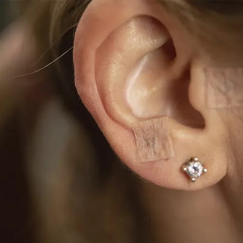 Persona recibiendo una sesión de auriculoterapia con pequeñas agujas o semillas en la oreja para estimular puntos energéticos y promover el equilibrio del cuerpo